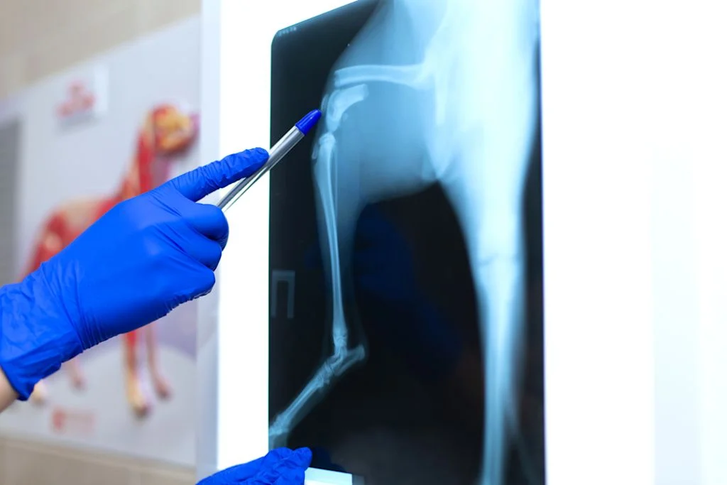 Fractura en una radiograf&iacute;a